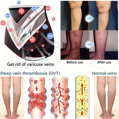 🎉 Limited-time offer – huge discount! 💰 Alisanda™ Self-regulating tourmaline shaping shorts with titanium fiber